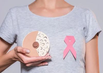 乳腺癌患者化疗后这些问题能不能解决?医师石毓斌是这么说的