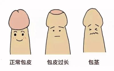 重庆治疗肿瘤老中医:阴茎癌的症状与又该怎么治疗