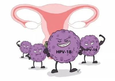 重庆肿瘤老中医罗登祥:外阴癌和阴道炎如何才能分清,青春期女性需要注意什么