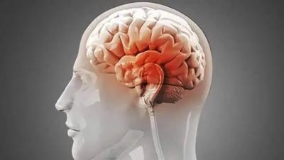 重庆肿瘤科老中医:牢记脑癌早期的症状特点,早期发现早治疗
