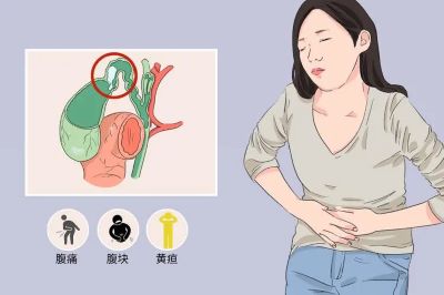 重庆中医肿瘤医师给大家科普一下胆囊癌的症状与体征