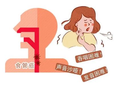 中医治疗食管瘤有哪些优势?看完重庆肿瘤老中医讲解你就明白了