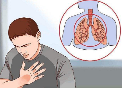 中西医结合治疗肺癌究竟有什么好处?重庆治疗肺癌老中医解答